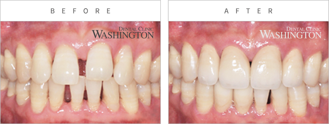 심미클리닉 Before & After