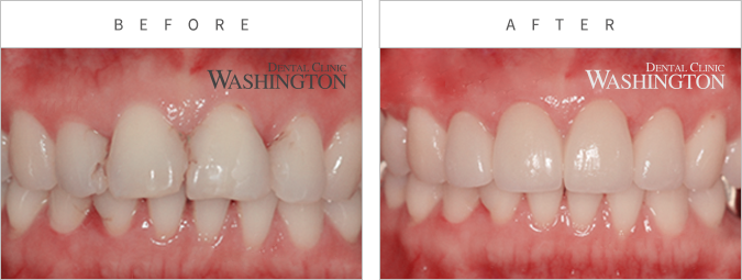 심미클리닉 Before & After