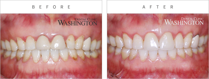 심미클리닉 Before & After