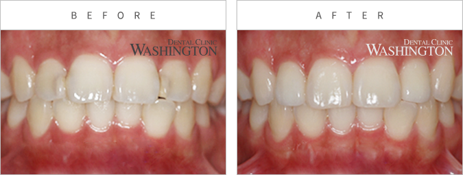 심미클리닉 Before & After