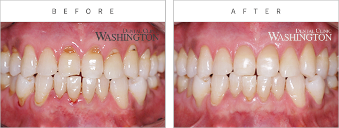심미클리닉 Before & After