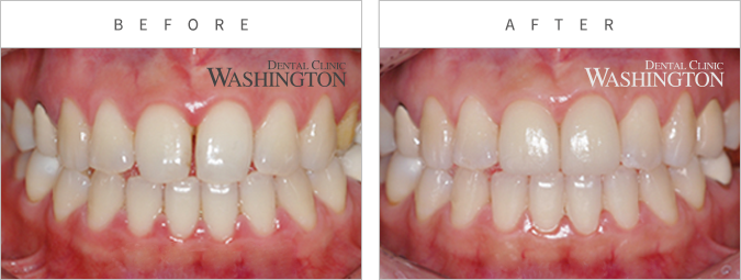 심미클리닉 Before & After