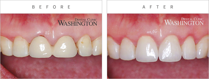 심미클리닉 Before & After