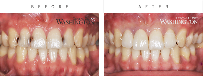 심미클리닉 Before & After