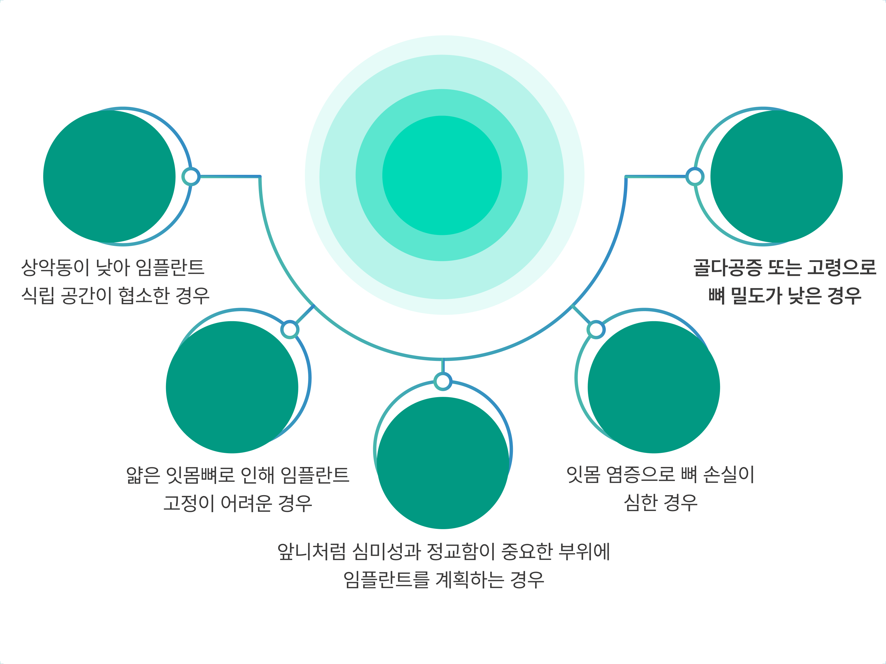 뼈이식 임플란트 대상자