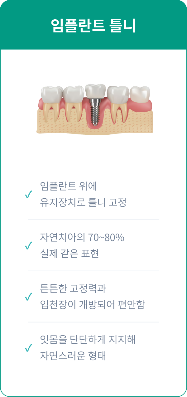 임플란트 틀니