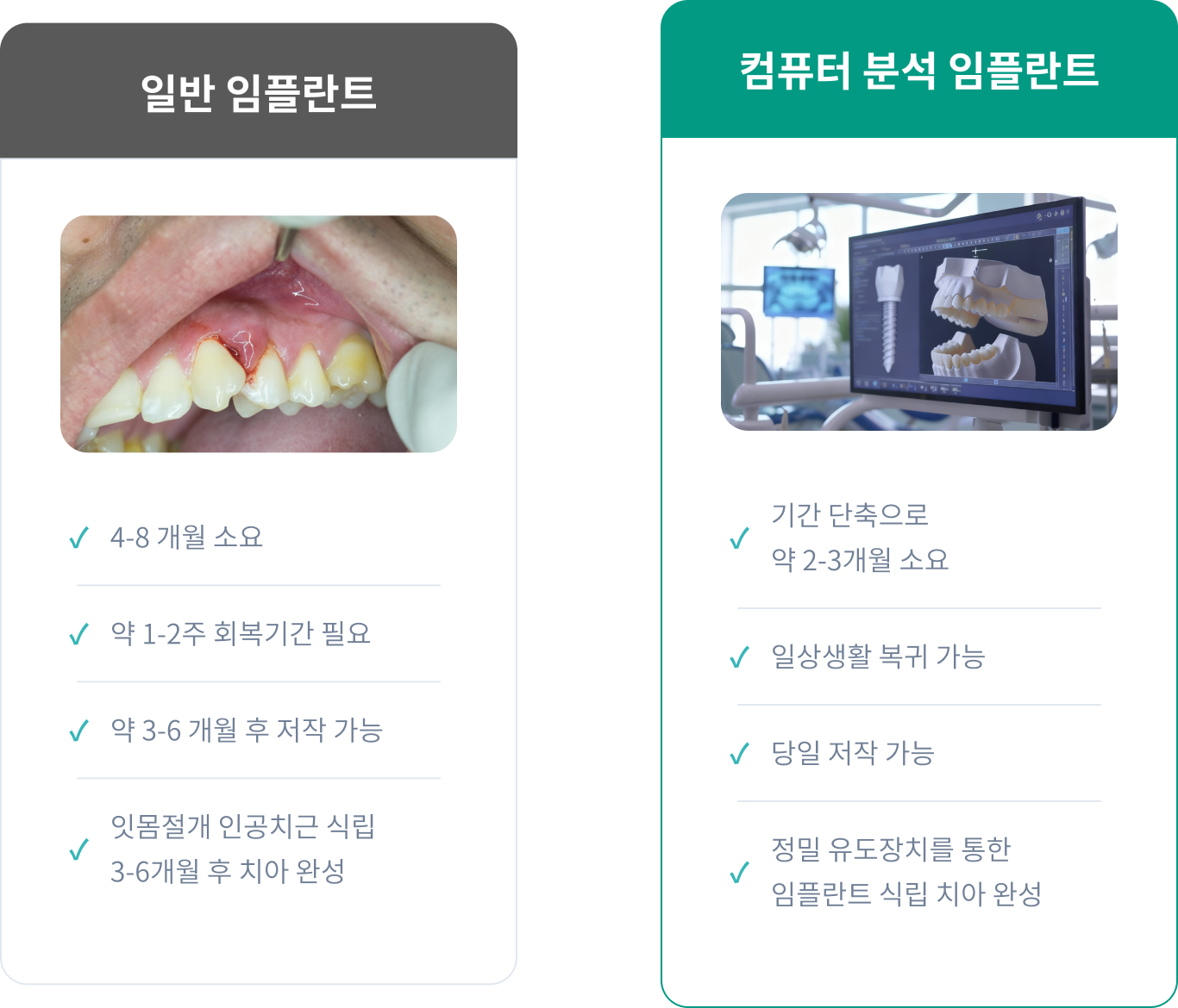 일반 임플란트 vs 컴퓨터 분석 임플란트 비교