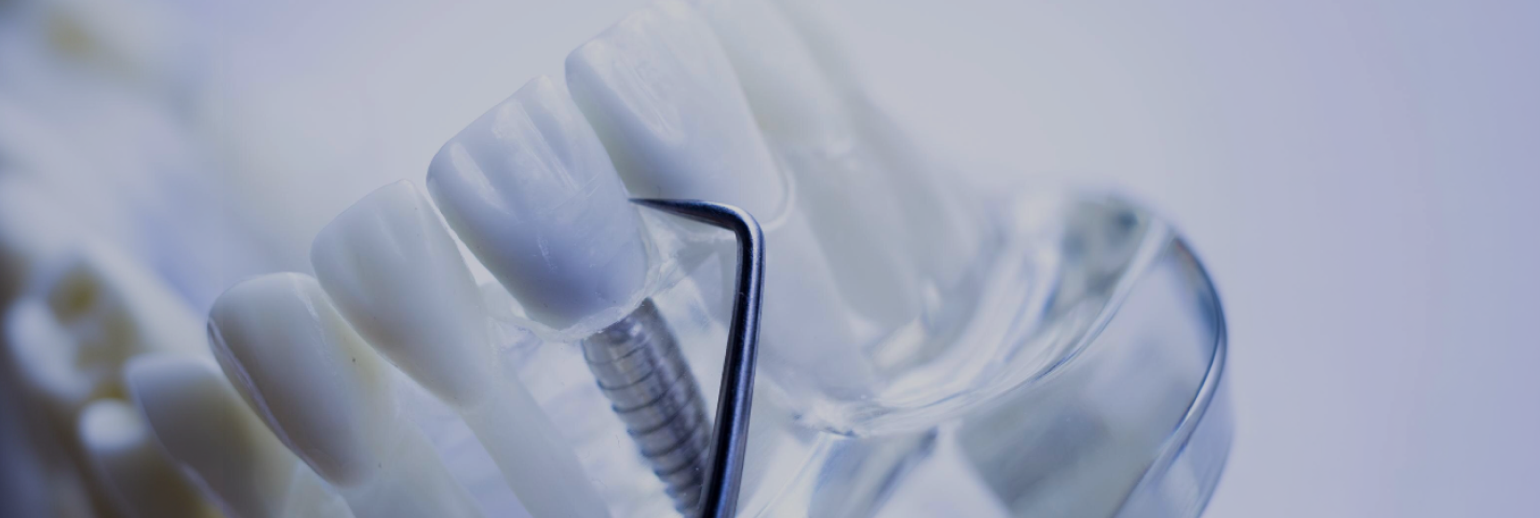 한 번의 임플란트, 평생의 약속