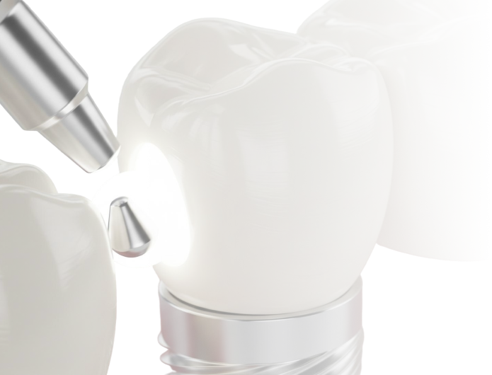 시술이 끝나도, 관리의 시작은 엠치과에서