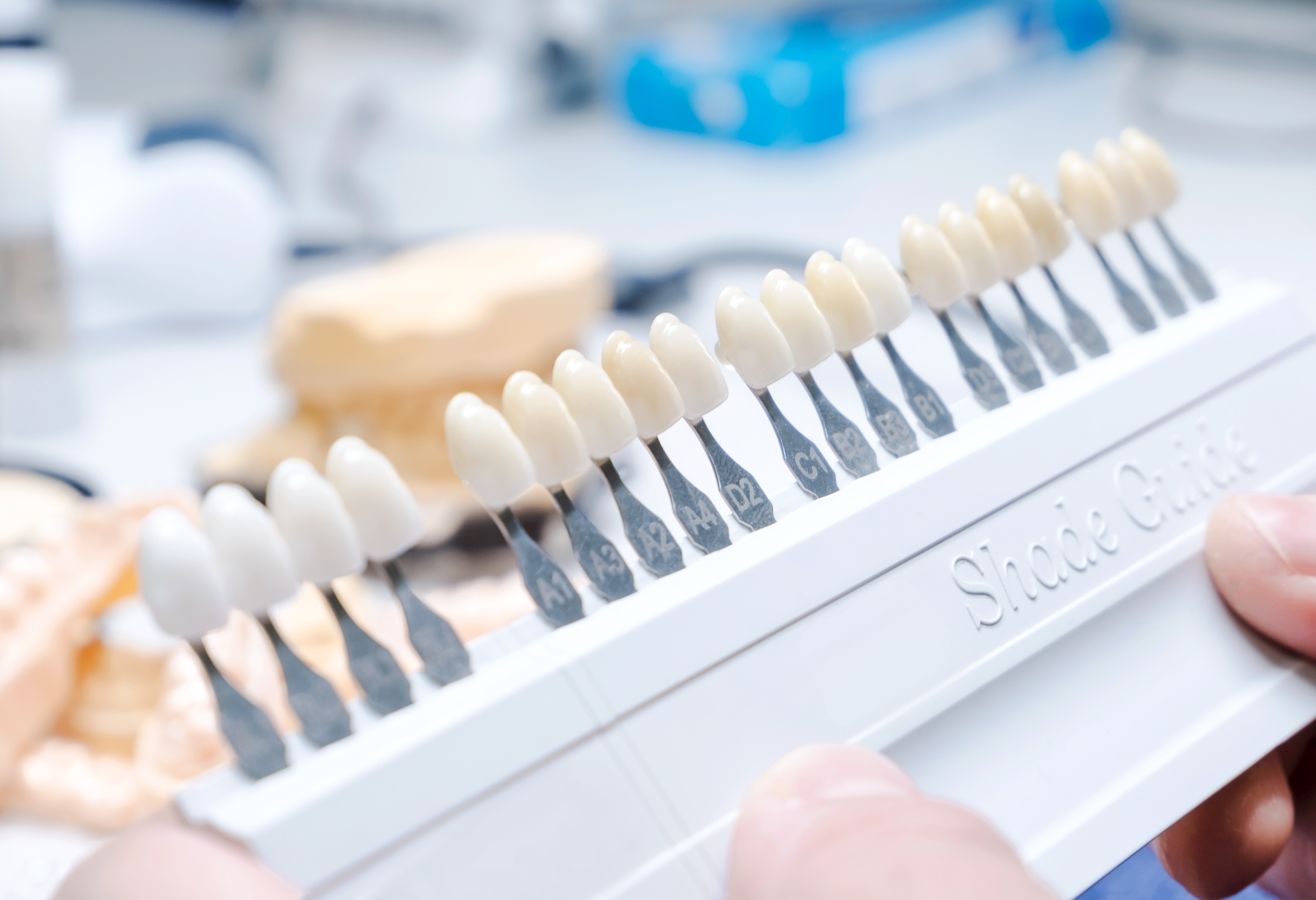 치아 색상 가이드